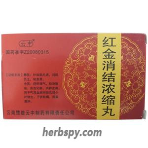 Hongjin Xiaojie Nongsuowan for ovarian cysts and breast lobular hyperplasia